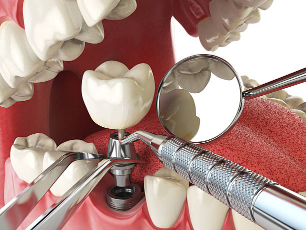 Best Emergency Denture Repair in Thousand Oaks, CA